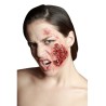 Appliance - infected itchy