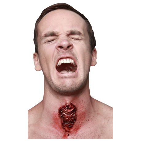 Appliance - traqueotomy