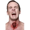 Appliance - traqueotomy