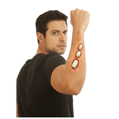 Appliance - Forearm Bones