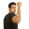 Appliance - Forearm Bones